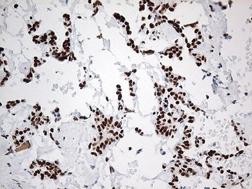 EWSR1 Antibody in Immunohistochemistry (Paraffin) (IHC (P))