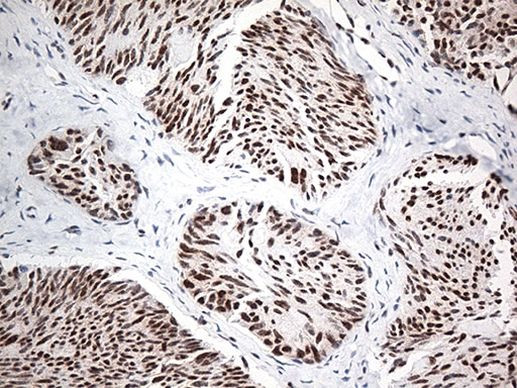 EWSR1 Antibody in Immunohistochemistry (Paraffin) (IHC (P))