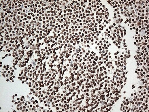 EWSR1 Antibody in Immunohistochemistry (Paraffin) (IHC (P))