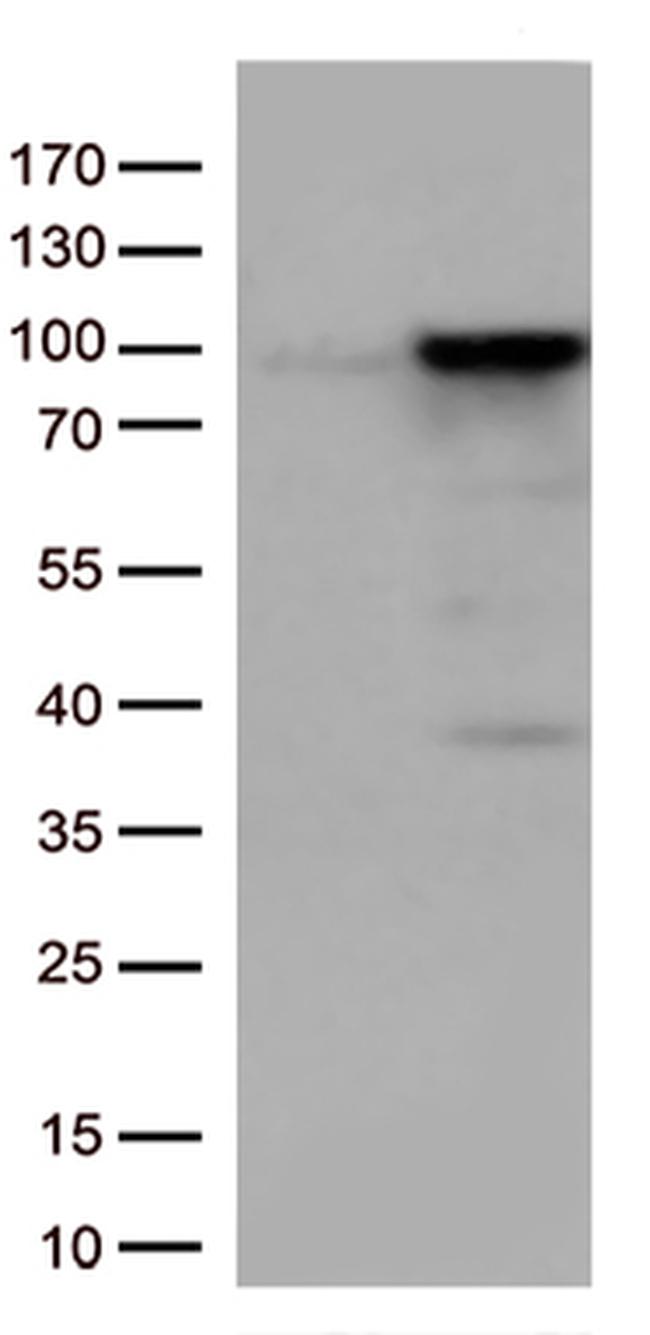 EWSR1 Antibody in Western Blot (WB)