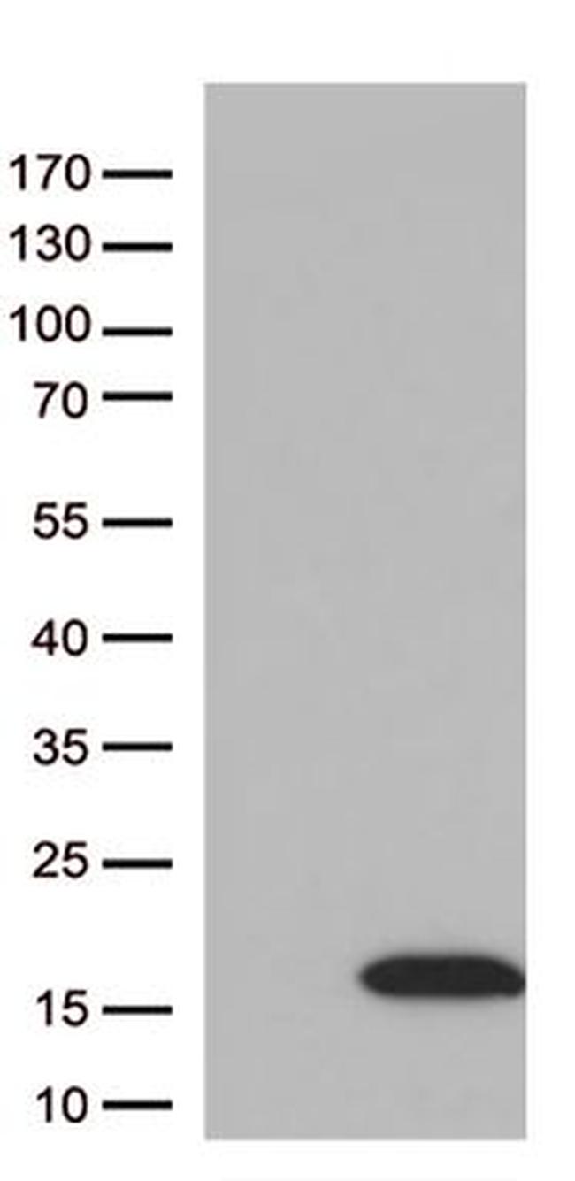 DBI Antibody in Western Blot (WB)