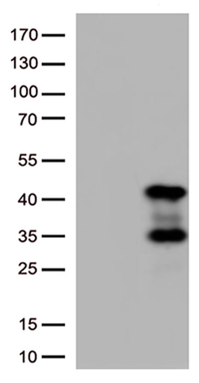 AMPK beta 1 (PRKAB1) Antibody in Western Blot (WB)