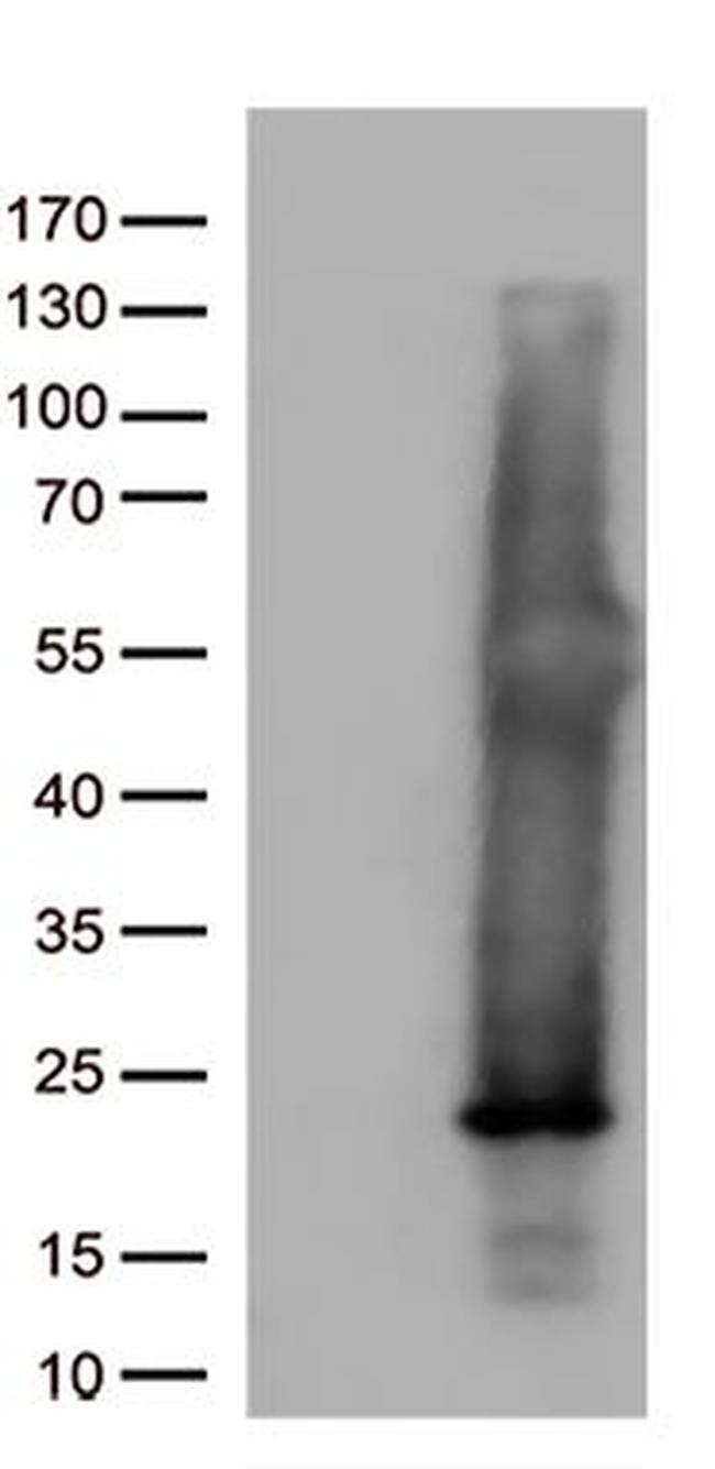 ASF1B Antibody in Western Blot (WB)