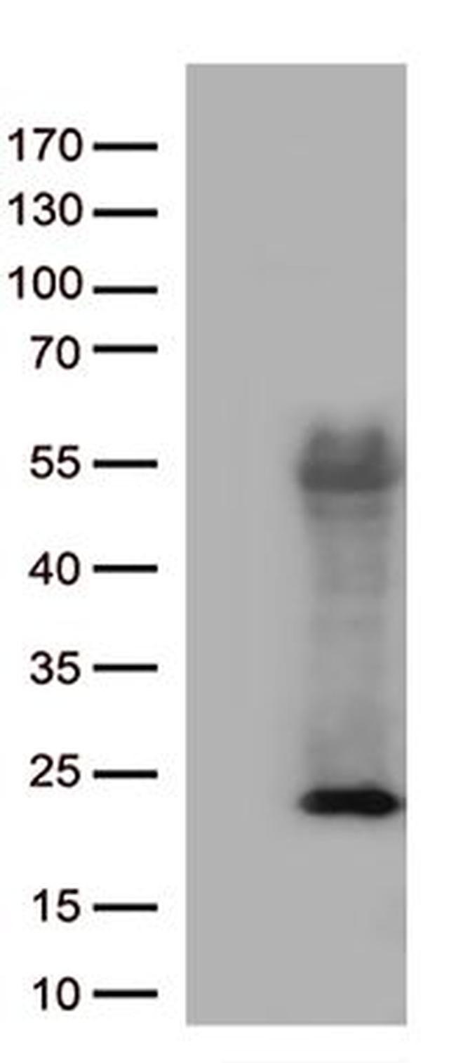 ASF1B Antibody in Western Blot (WB)