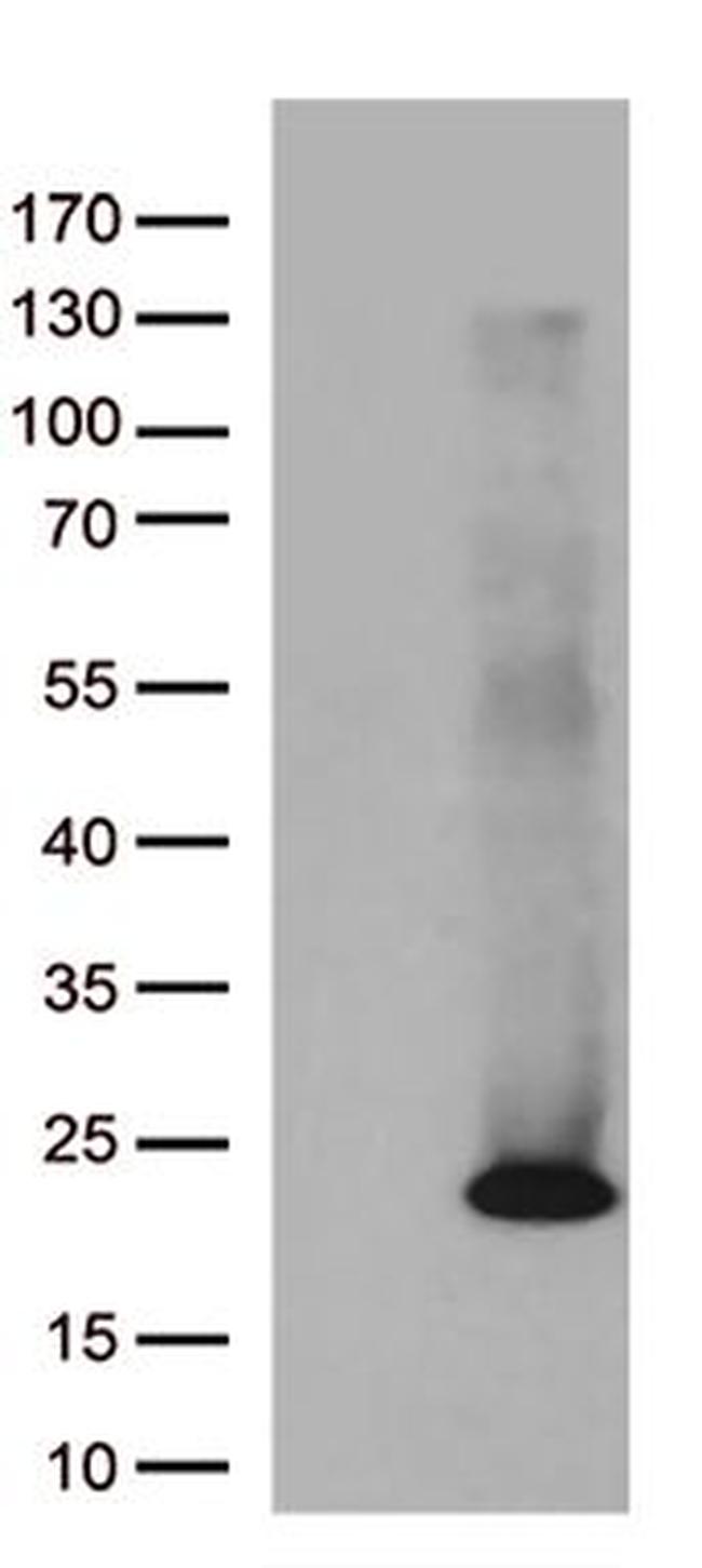 ASF1B Antibody in Western Blot (WB)