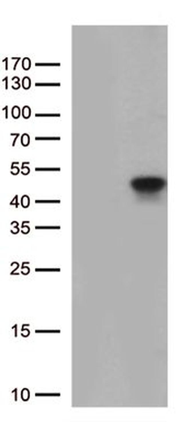 PTER Antibody in Western Blot (WB)