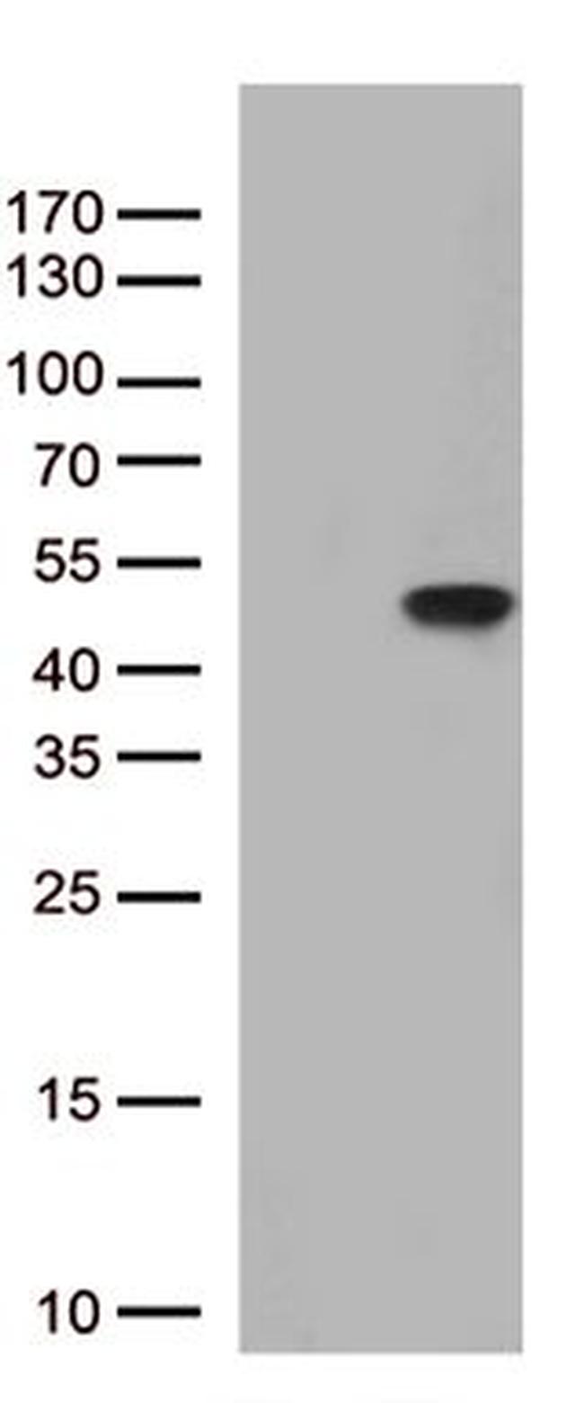 PTER Antibody in Western Blot (WB)