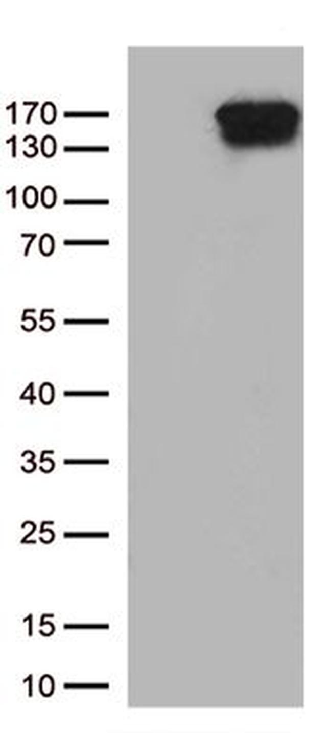 TRPS1 Antibody in Western Blot (WB)