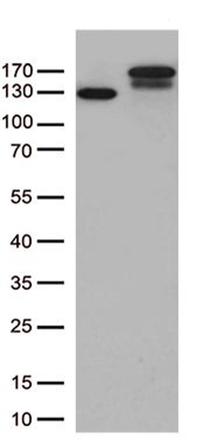 TRPS1 Antibody in Western Blot (WB)