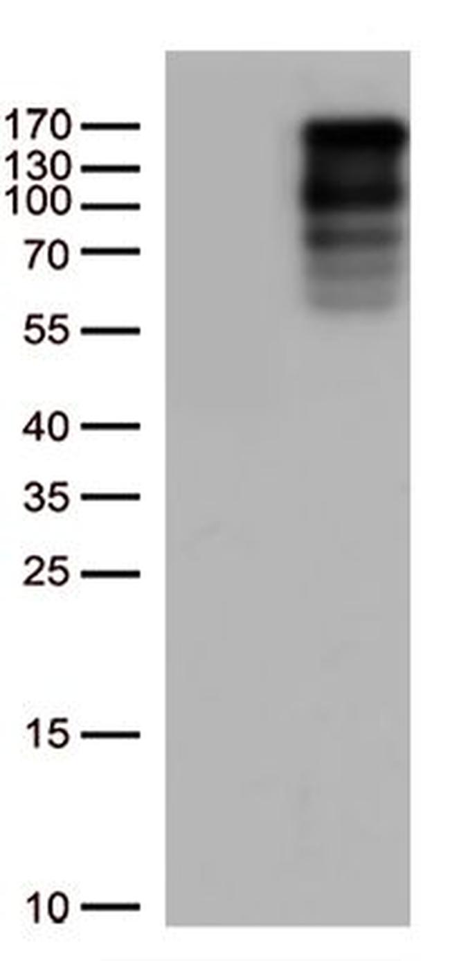 LARP1 Antibody in Western Blot (WB)