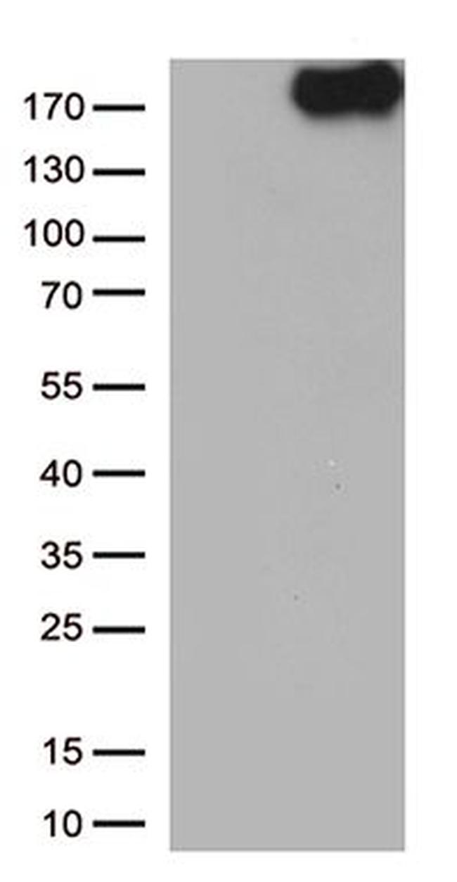 NPHS1 Antibody in Western Blot (WB)