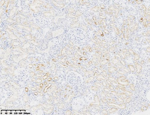 MDR-1/ABCB1 Antibody in Immunohistochemistry (Paraffin) (IHC (P))