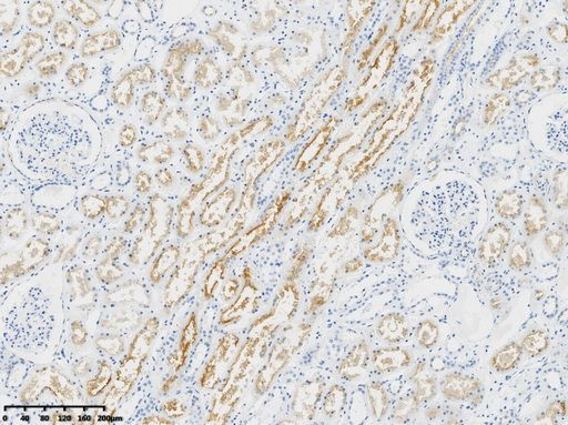 MDR-1/ABCB1 Antibody in Immunohistochemistry (Paraffin) (IHC (P))