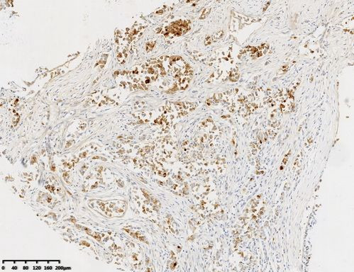 GCDFP-15 Antibody in Immunohistochemistry (Paraffin) (IHC (P))