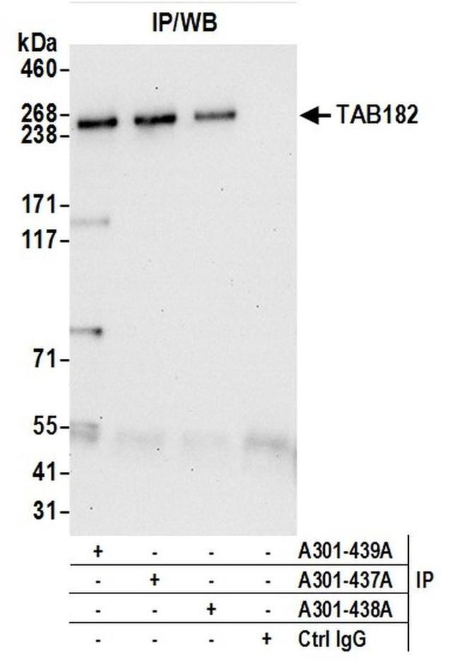 TAB182 Antibody in Western Blot (WB)