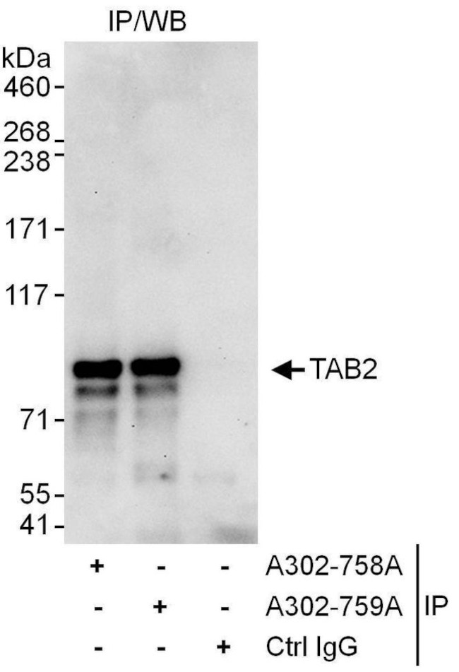 TAB2 Antibody in Immunoprecipitation (IP)