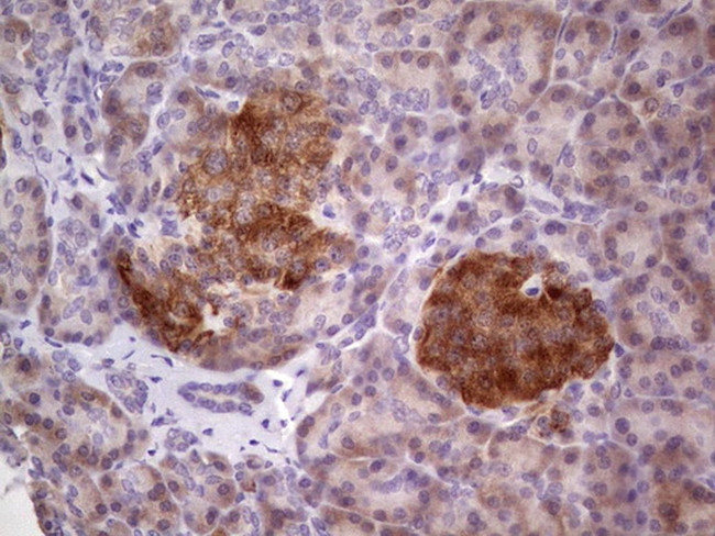 TACC1 Antibody in Immunohistochemistry (Paraffin) (IHC (P))