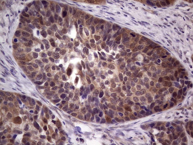 TACC1 Antibody in Immunohistochemistry (Paraffin) (IHC (P))