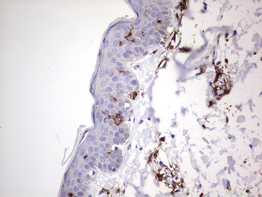 TACC2 Antibody in Immunohistochemistry (Paraffin) (IHC (P))