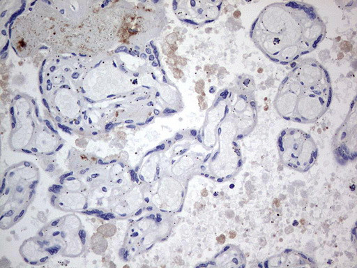 TACC2 Antibody in Immunohistochemistry (Paraffin) (IHC (P))