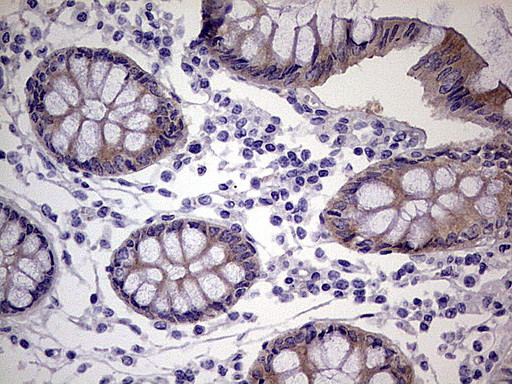 TACC2 Antibody in Immunohistochemistry (Paraffin) (IHC (P))