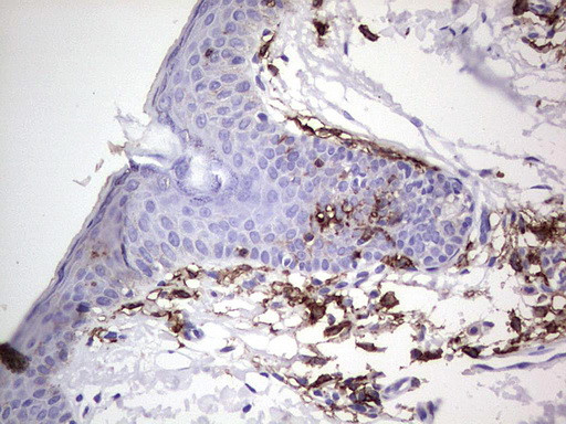 TACC2 Antibody in Immunohistochemistry (Paraffin) (IHC (P))