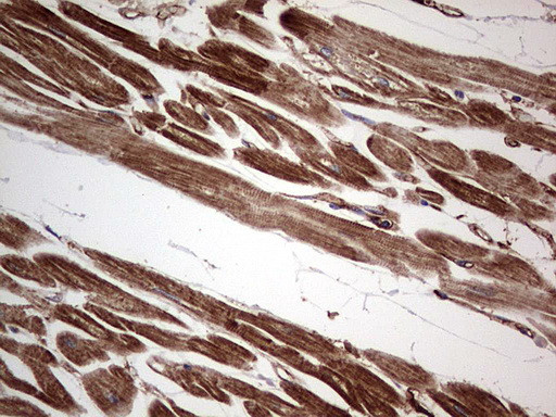 TACC2 Antibody in Immunohistochemistry (Paraffin) (IHC (P))