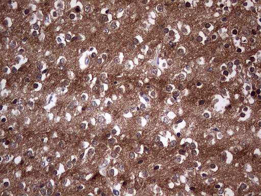 TACC2 Antibody in Immunohistochemistry (Paraffin) (IHC (P))