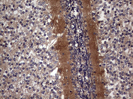 TACC2 Antibody in Immunohistochemistry (Paraffin) (IHC (P))