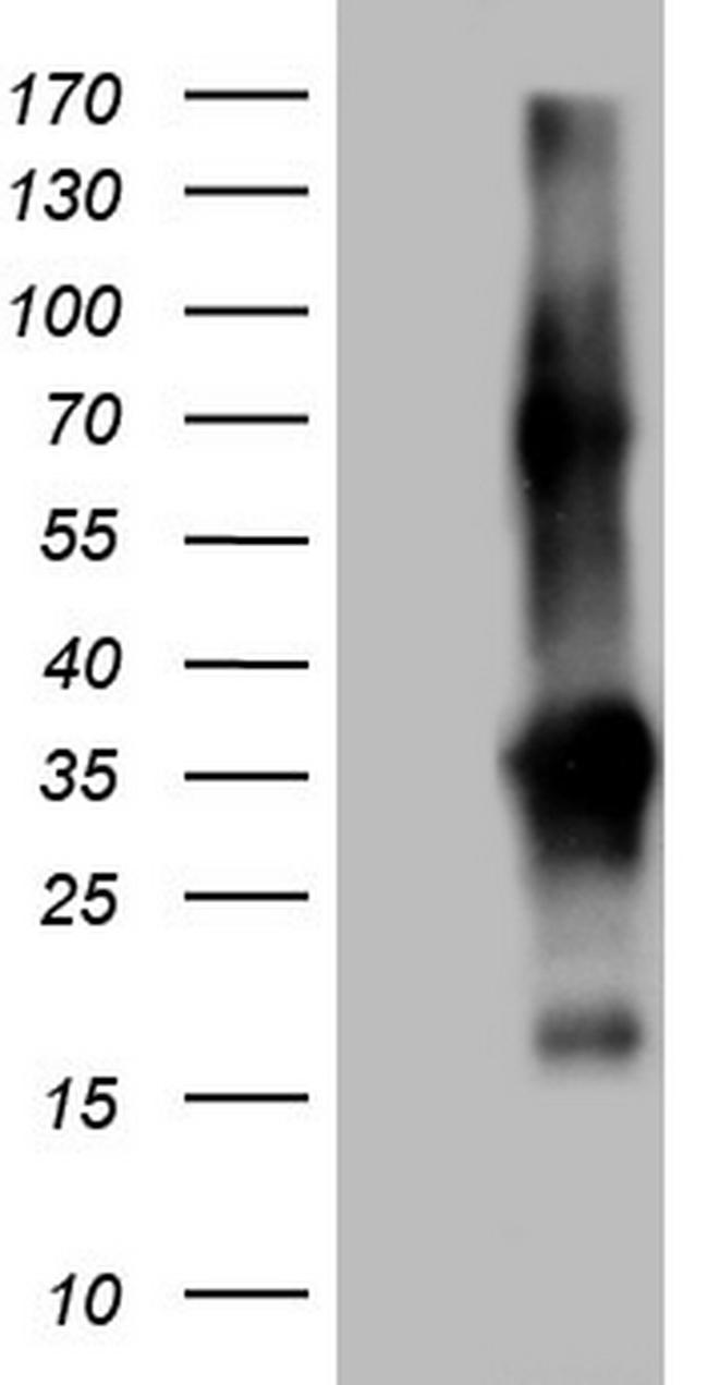 TACC2 Antibody in Western Blot (WB)