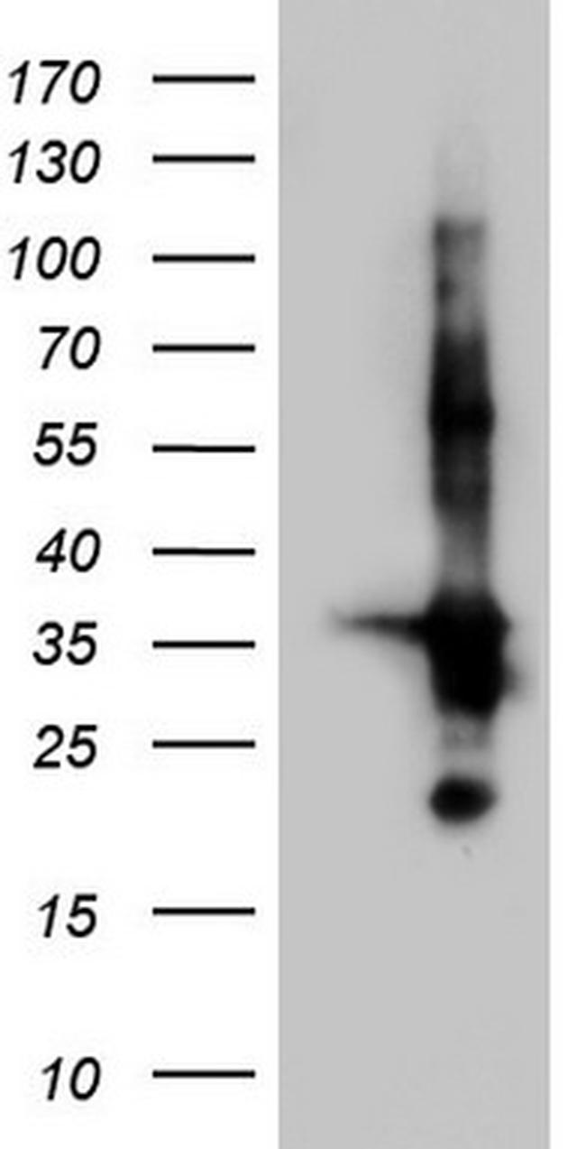 TACC2 Antibody in Western Blot (WB)