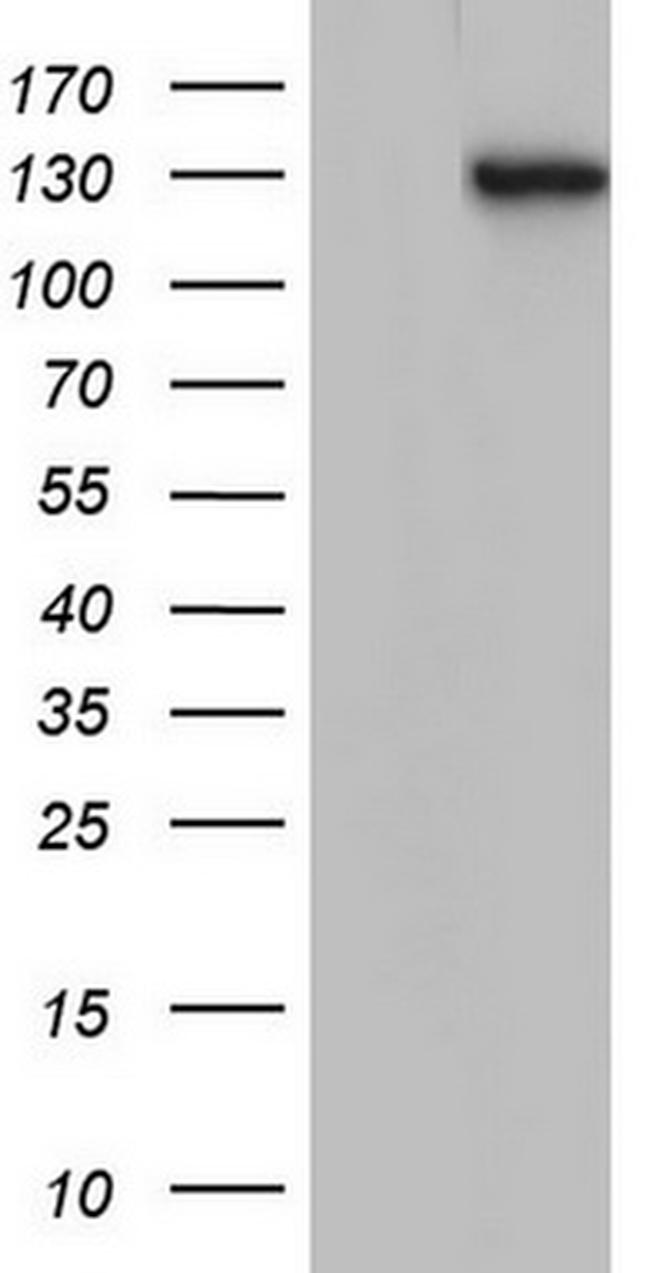 TACC2 Antibody in Western Blot (WB)