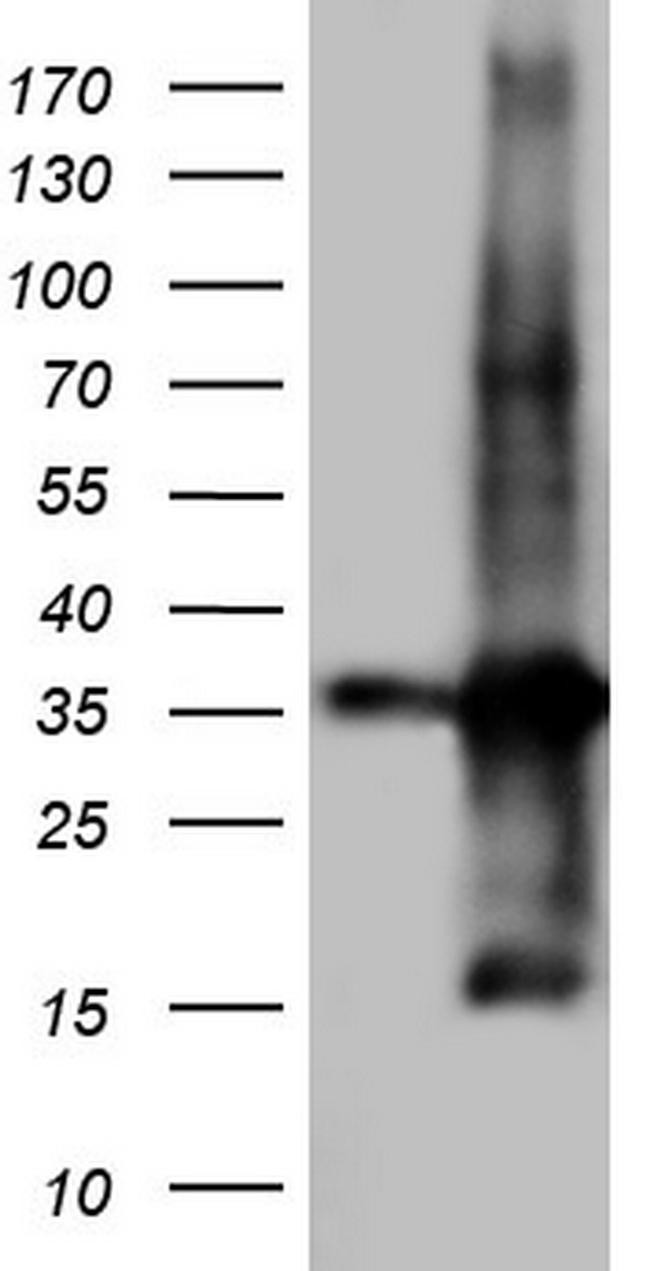 TACC2 Antibody in Western Blot (WB)