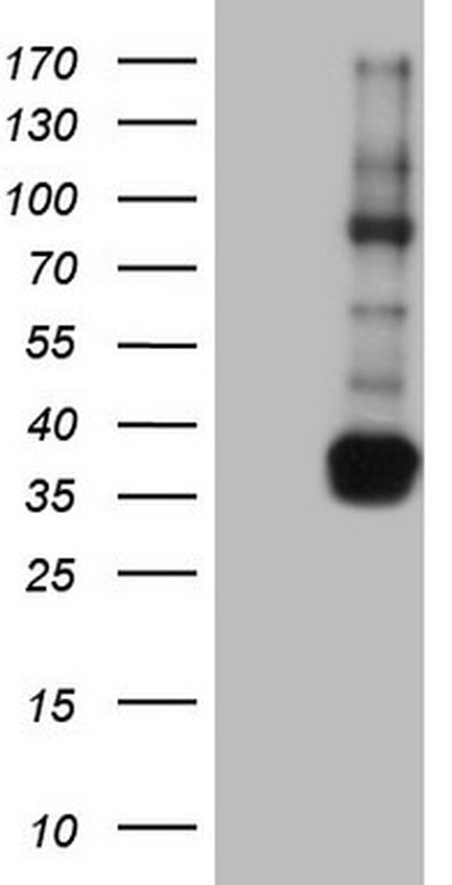 TACC2 Antibody in Western Blot (WB)