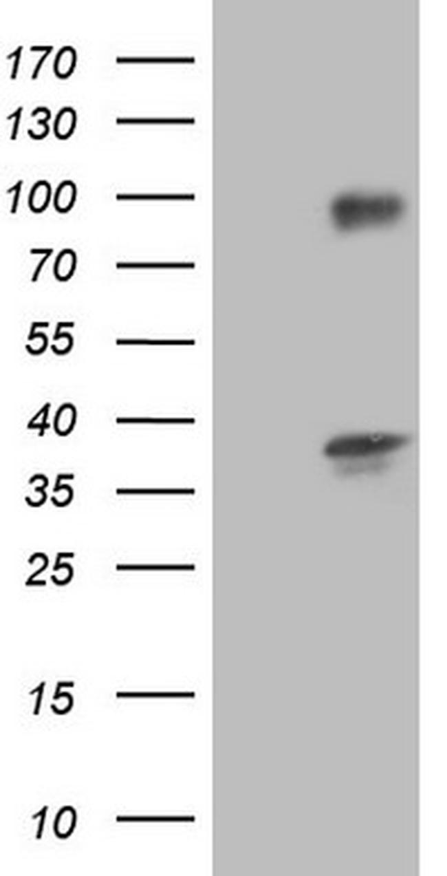 TACC2 Antibody in Western Blot (WB)