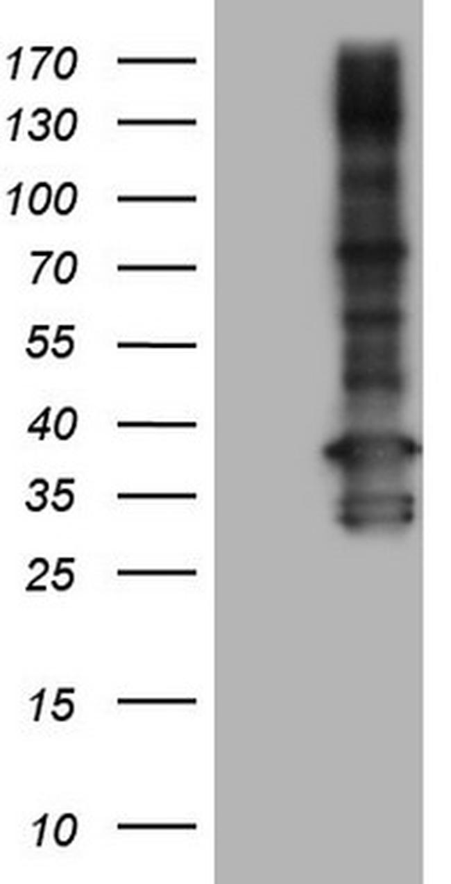 TACC2 Antibody in Western Blot (WB)