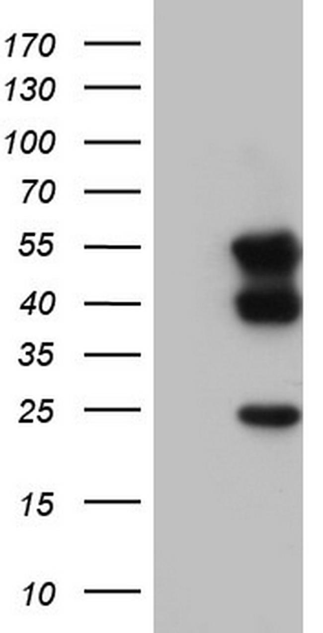 TACC2 Antibody in Western Blot (WB)