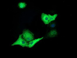 TACC3 Antibody in Immunocytochemistry (ICC/IF)