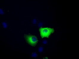 TACC3 Antibody in Immunocytochemistry (ICC/IF)