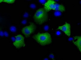 TACC3 Antibody in Immunocytochemistry (ICC/IF)