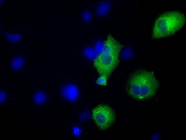 TACC3 Antibody in Immunocytochemistry (ICC/IF)