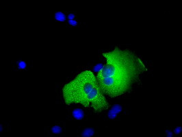 TACC3 Antibody in Immunocytochemistry (ICC/IF)