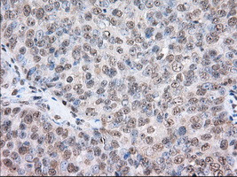 TACC3 Antibody in Immunohistochemistry (Paraffin) (IHC (P))