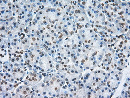 TACC3 Antibody in Immunohistochemistry (Paraffin) (IHC (P))