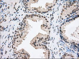 TACC3 Antibody in Immunohistochemistry (Paraffin) (IHC (P))