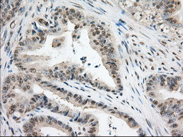 TACC3 Antibody in Immunohistochemistry (Paraffin) (IHC (P))