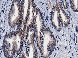 TACC3 Antibody in Immunohistochemistry (Paraffin) (IHC (P))