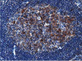 TACC3 Antibody in Immunohistochemistry (Paraffin) (IHC (P))