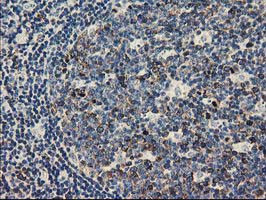 TACC3 Antibody in Immunohistochemistry (Paraffin) (IHC (P))