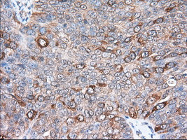 TACC3 Antibody in Immunohistochemistry (Paraffin) (IHC (P))